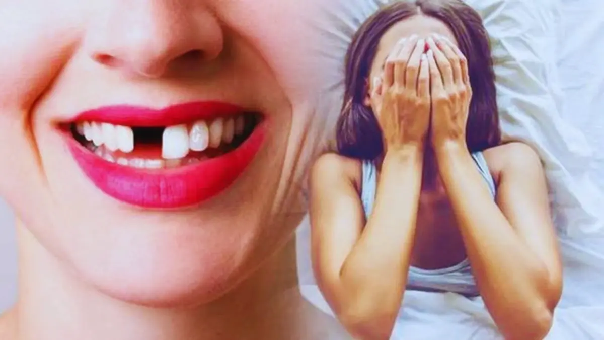 تفسير حلم سقوط الأسنان الأمامية ذو دلالة مختلفة عن الأسنان السفلية