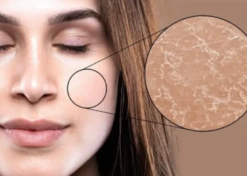 أخطاء تدمر بشرتك في رمضان