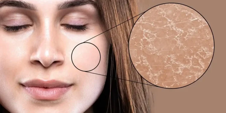 أخطاء تدمر بشرتك في رمضان