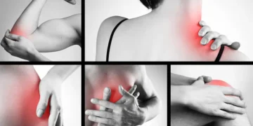 خريطة توضح مناطق تخزين الصدمات في الجسم