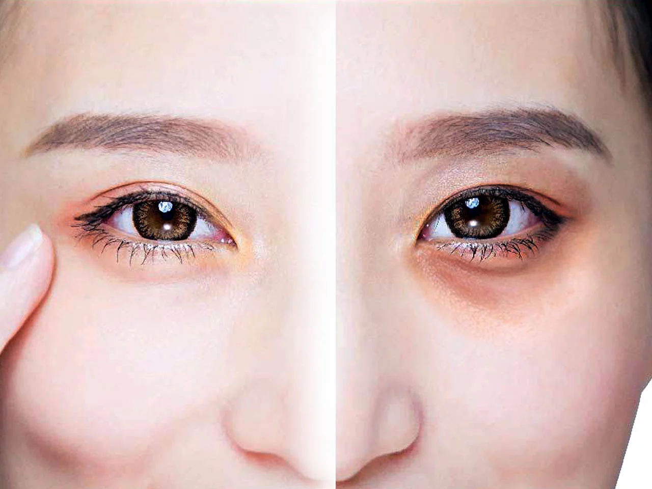 الهالات السوداء في رمضان بسبب قلة النوم والإرهاق